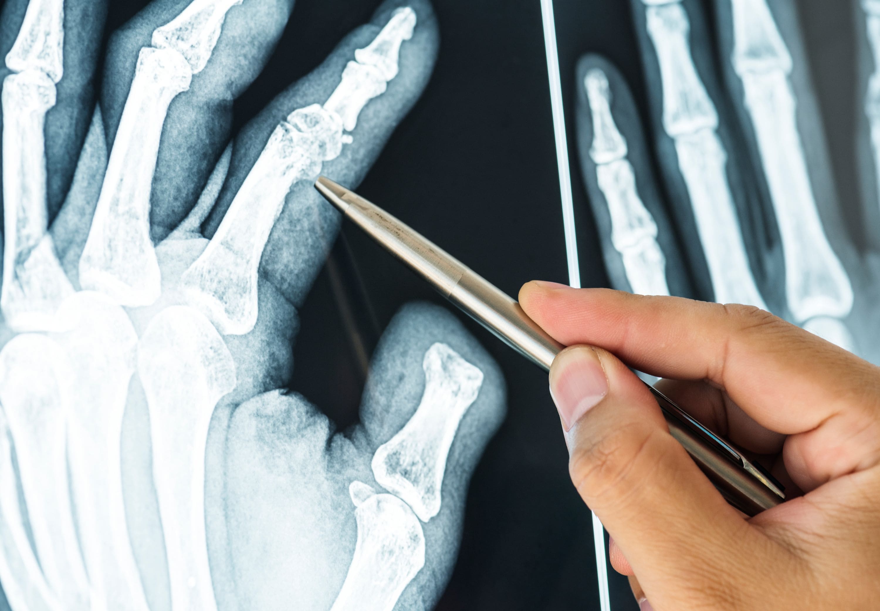 cirugia-articular-en-cdmx-cerca-de-mi.jpg